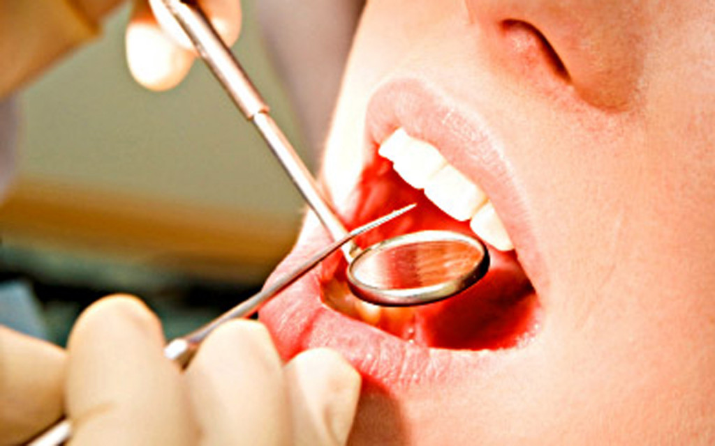 Igiene orale e prevenzione